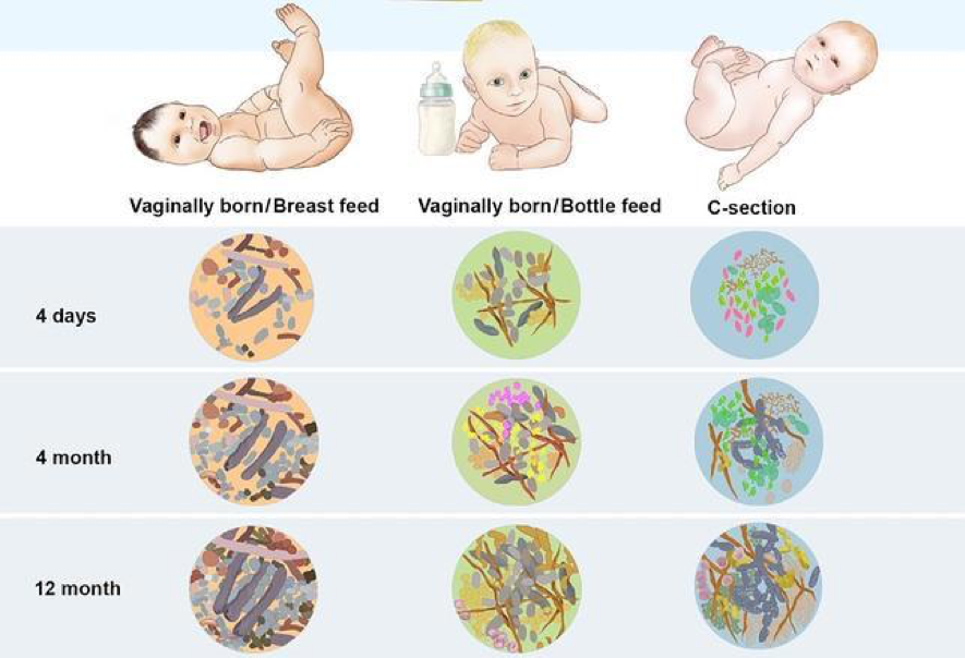 Microbiota de un niño de acuerdo a cómo nació